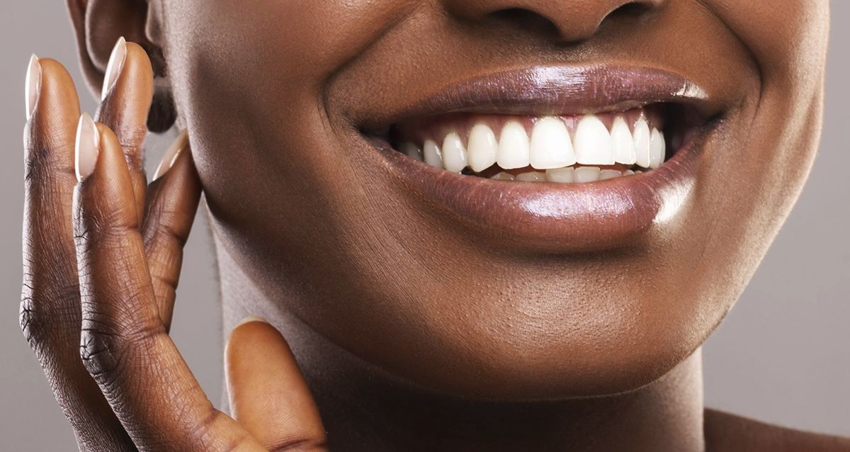 Transform Your Smile with Porcelain Veneers at Chamberlain Dental