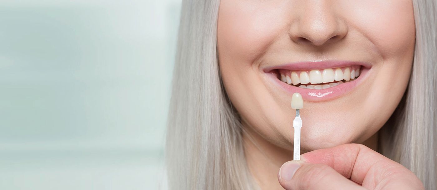 The Secret Behind the Perfect Smile: Porcelain Veneers