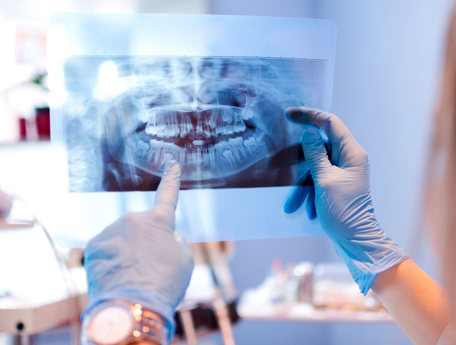 The Advantages of Digital X-Rays in Modern Dentistry