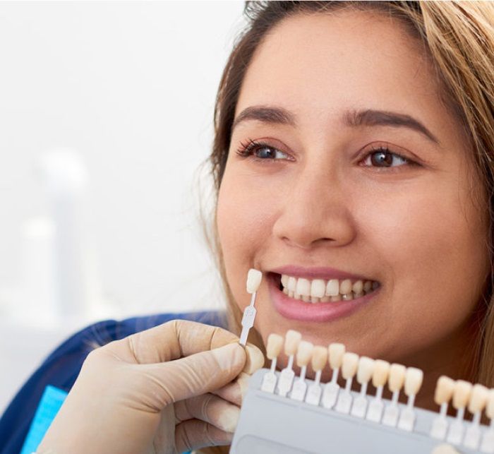 porcelain veneers